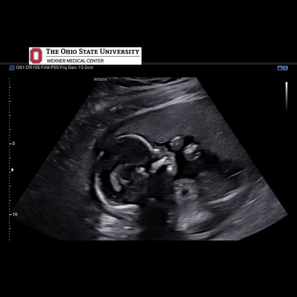 Meet your Posher, Sean - Picture 1 of 1